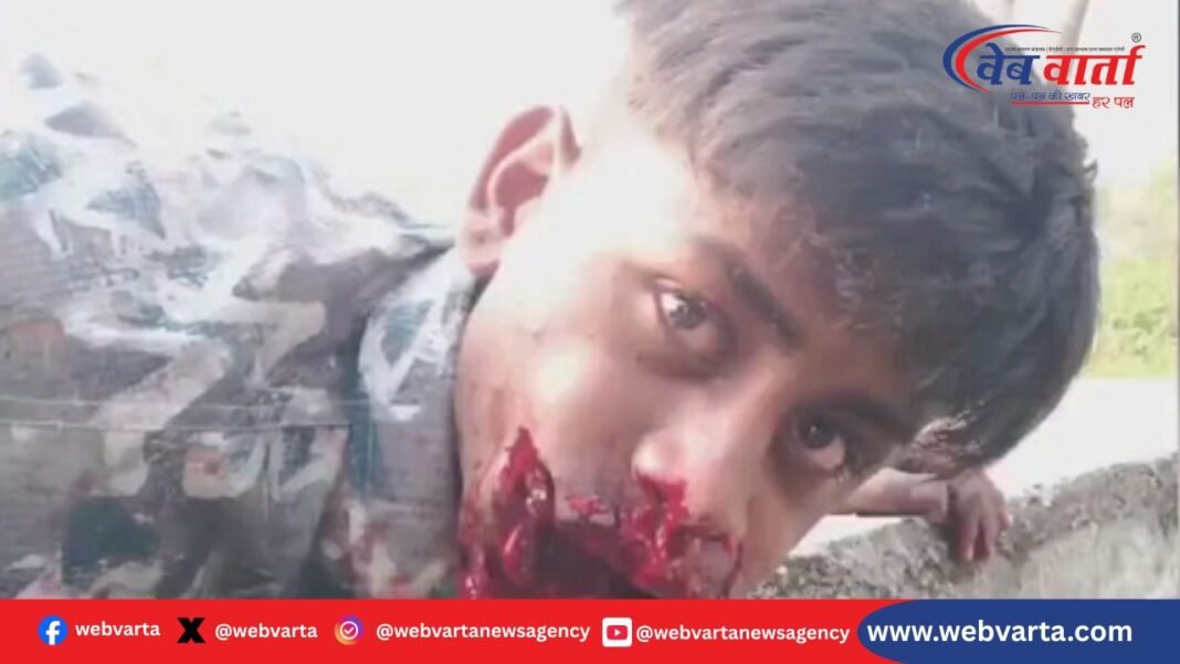 Jhabua झाबुआ सुतली बम हादसा युवक जबड़ा चोट 2025