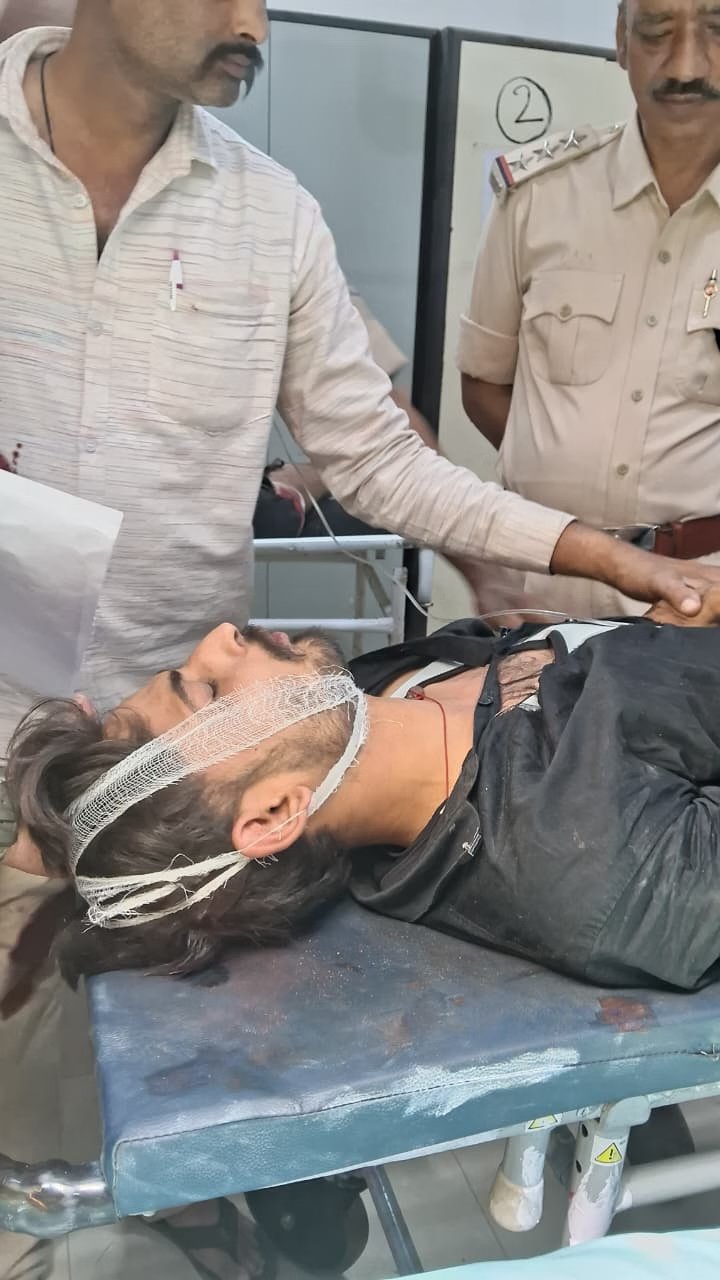 Satna Crime: सतना में मामूली विवाद बना फायरिंग की वजह, युवक के पैर में लगी गोली; मामले की जांच शुरू